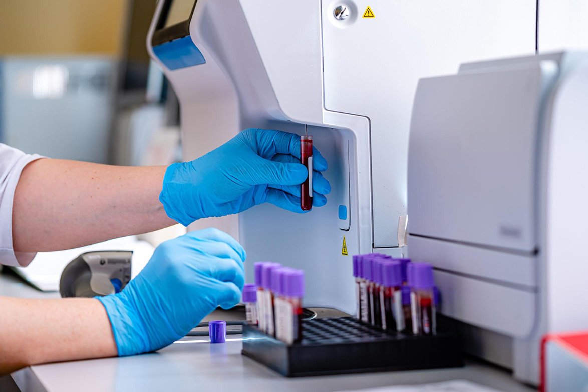 Advanced Blood Testing at NovaWell Dubai